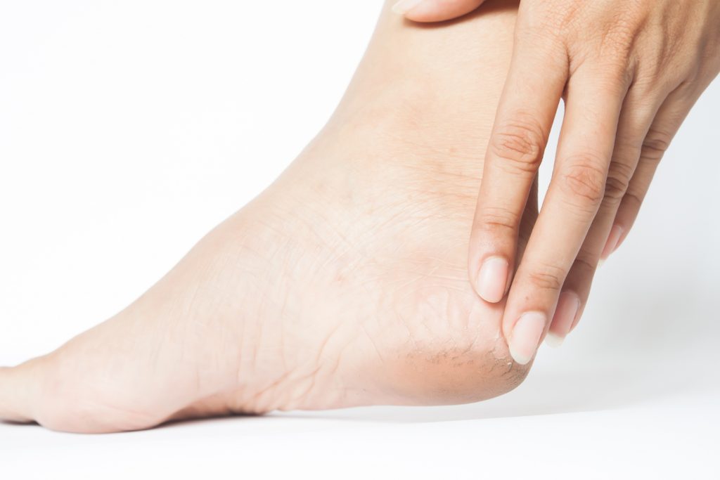 Heel stone bruises, seemingly commonly placed, can be a source of considerable discomfort and hindered mobility. These injuries, often resulting from impact or repetitive stress, affect the sensitive tissues in the heel, leading to pain and potential complications if left unattended.